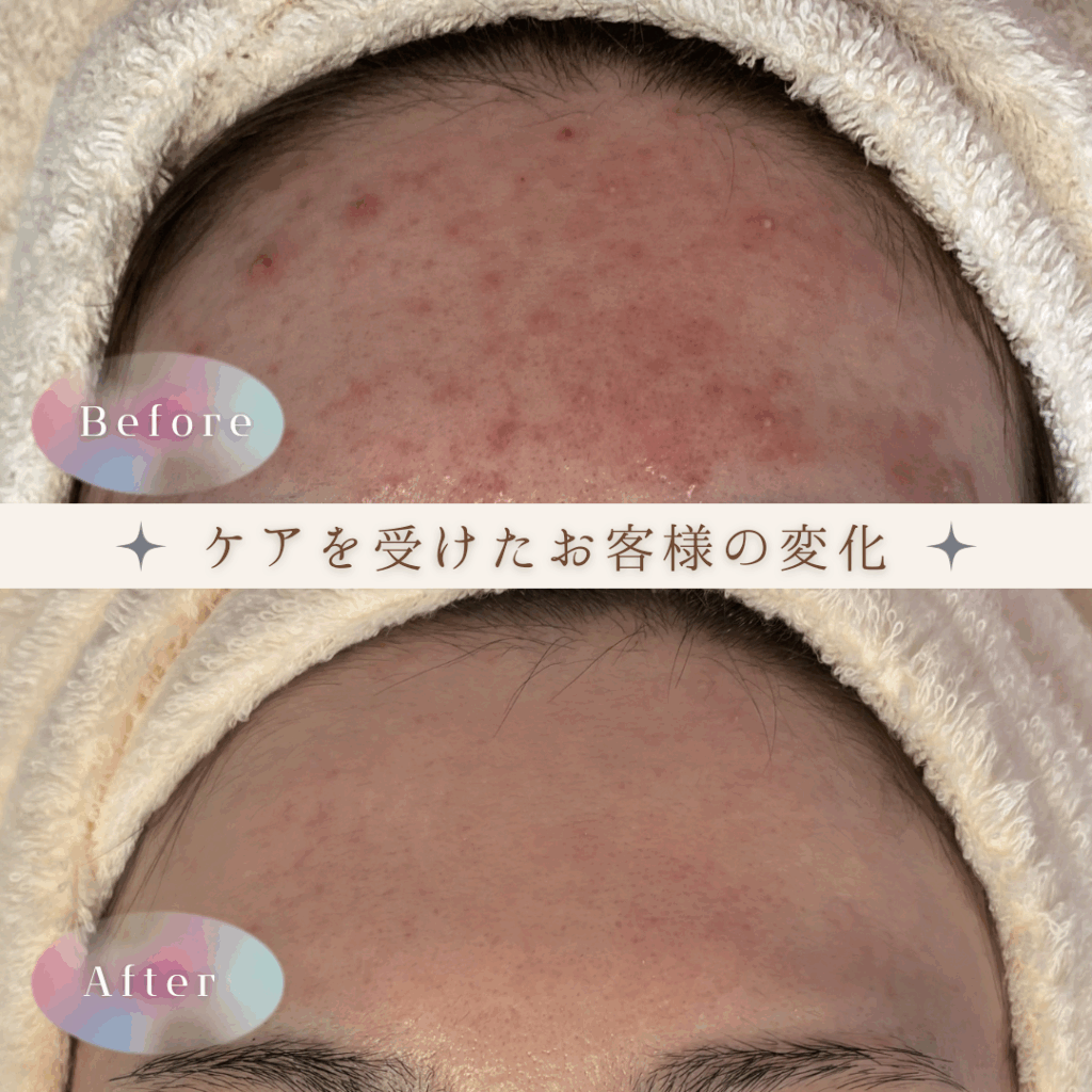 ビフォーアフター1